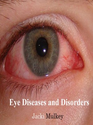 cover image of Eye Diseases and Disorders